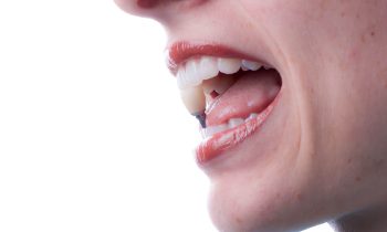 Zahnimplantat Moers Zahnarztpraxis