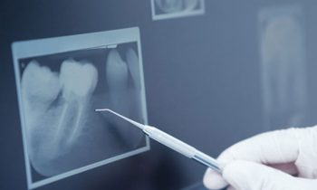 Endodontie Zahnarzt