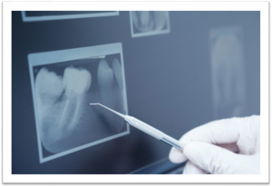 endodontie Zahnarztpraxis Moers
