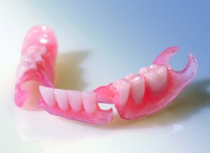 valplast Prothesenmaterial -zahnarzt moers