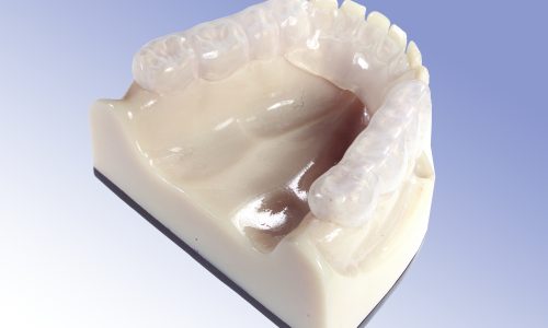 Valplast Ästhetische Zahnmedizin Moers